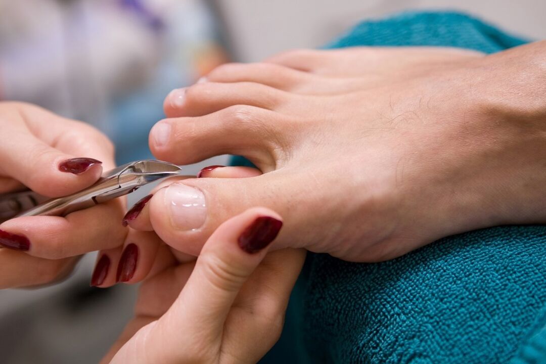 pedicure als een manier om nagelschimmel te infecteren