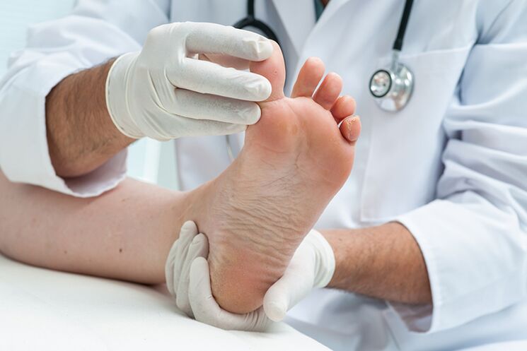 Dermatoloog onderzoekt de benen van de patiënt